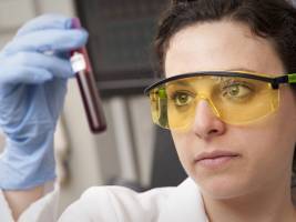 Blood and brain fluid change first in Huntington's disease