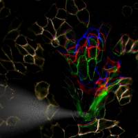 How skin cells protect themselves against stress