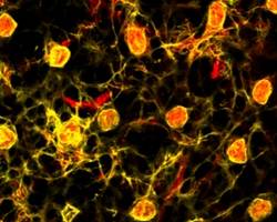 Important step towards a computer model that predicts the outcome of eye diseases