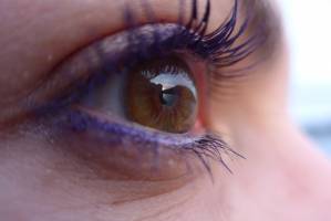 Outbreak of preventable eye infection in contact lens wearers