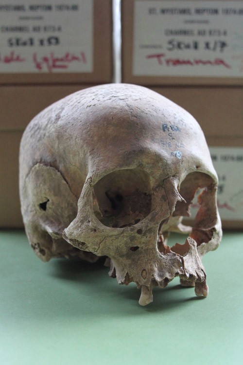 One of the female skulls from the Repton charnel
                           Cat