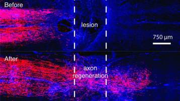 Regenerating nerve fibers across spinal cord injury