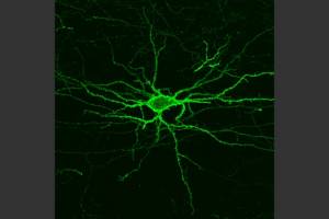 Seeing the brain's electrical activity