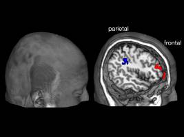 Spoilt for choice? How neuroscience can explain your attitude toward freedom of choice