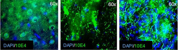 Stroke : preventing the damage by acting on the neuronal environment ?