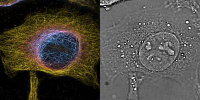 Super-resolution microscopy in both space and time