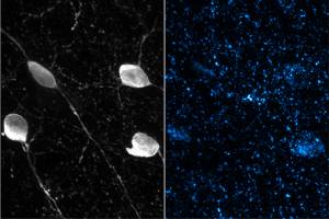 A fundamental neuronal microcircuit for learning
