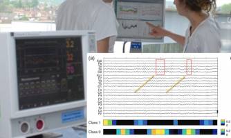 AI-based prognosis in intensive care: decision-relevant patterns identified in EEG of coma patients