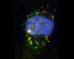 How do mRNAs deal with stress?