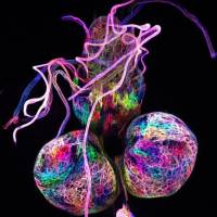 Looking into the fly's brain