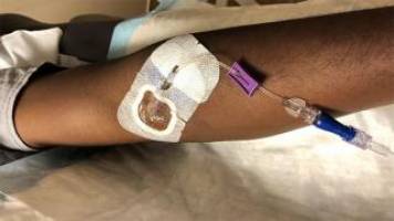 Promising results in the fight against Ebola