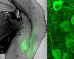 Stressed, anxious? Ask the brain!