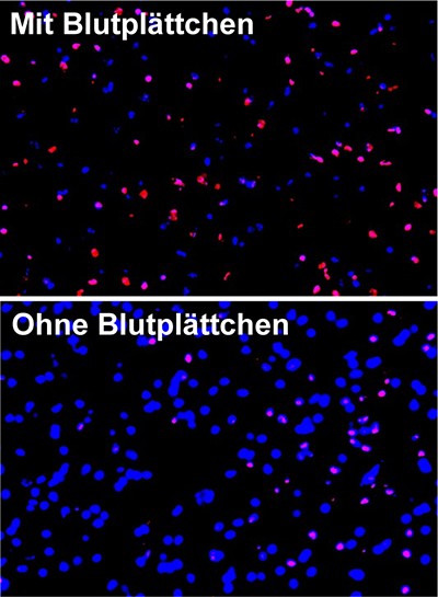 Nach einem Schlaganfall l�sen Blutpl�ttchen ein Selbstmordprogramm (Apoptose) in