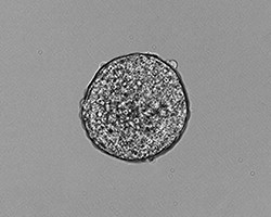A growing mouse embryonic stem cell colony