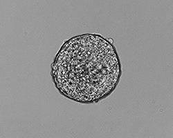 Unlocking the secrets of an important regulator of human development