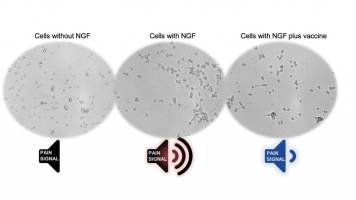 Vaccine developed to treat osteoarthritic pain