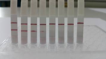 Where does this contamination come from?