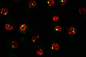 Histone degradation after DNA damage enhances repair