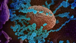 Scanned electron microscope image of the novel Coronavirus SARS-CoV-2 (photo: NI