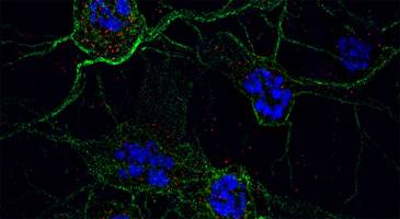 Unusual DNA structures involved in neuron ageing