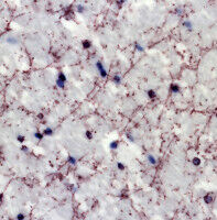 A new therapeutic target to combat addiction?