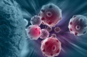 Astronomers apply their skills to cancer research