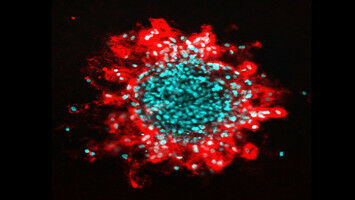 Breast cancers: ruptures in cell nuclei promotes tumor invasion