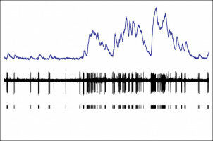 From imaging neurons to measuring their true activity