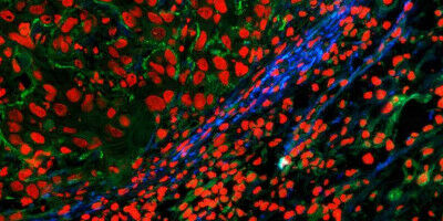 Illuminating tissue formation
