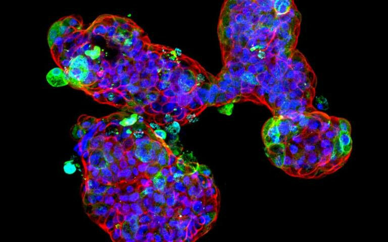 Mini stomachs - A microscopic image of the mini stomachs used in the research�So