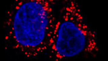 New discovery at the IOR on mechanisms leading to the spread of metastases