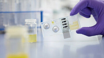 Novel Diagnostics to Improve Migrant and Refugee Health