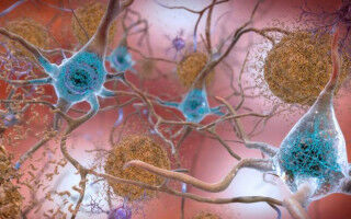 Potential cognitive benefits of major Alzheimer's risk gene
