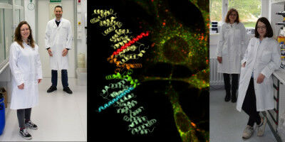 Research Team Investigates Causes of Tuberous Sclerosis