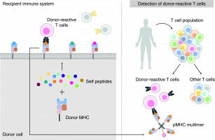 Study pinpoints molecular targets of transplant rejection