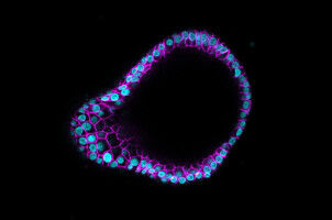 Uterine atlas can lead to better models of the womb, provide insights into diseases