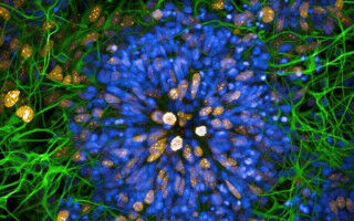 'Dementia in a dish' photo taken by UCL researcher wins research image competition
