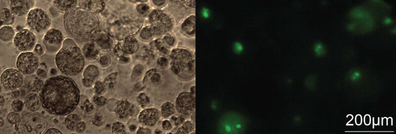 Microscopy pictures of three-dimentional lung cancer spheroids transfected with 