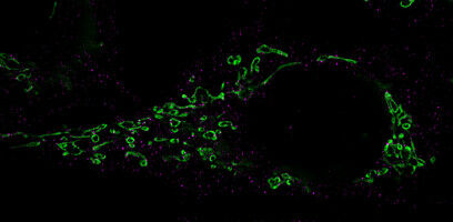 How Herpesviruses Awaken