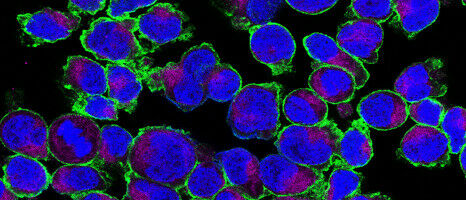 How sugar promotes inflammation