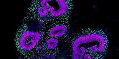 Mapping human brain development