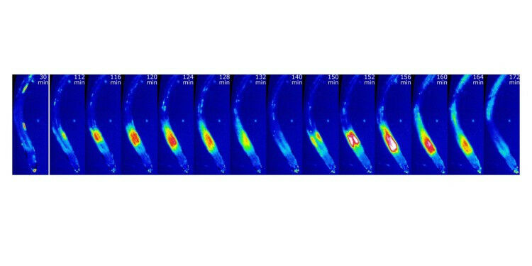 Arabidopsis seedlings have been exposed to manganese deficiency, and cytosolic c
