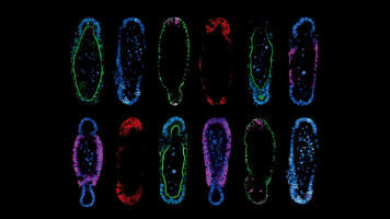Shape guides the growth of organoids