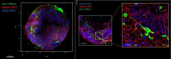 A neural organoid with an immune environment