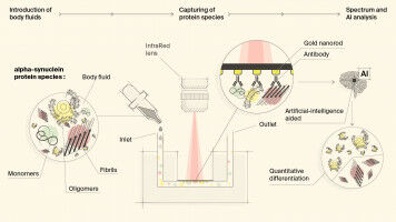 A Novel Biosensor for Detecting Neurogenerative Disease Protiens