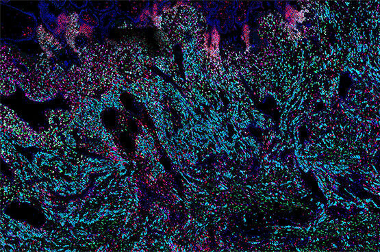 Researchers have revealed what happens in the early stages of placental developm