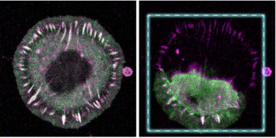 Demonstrating the significance of individual molecules during mechanical stress in cells
