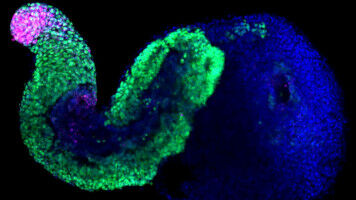 Embryoids shed light on a complex genetic mechanism
