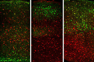 Expectation vs. Reality: study maps the neurons that tell the difference