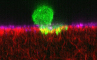 How cancer cells muscle their way into other organs